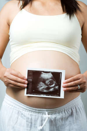 Беременная держит снимок УЗИ