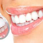Как можно отбелить зубы в домашних условиях