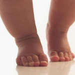 Что такое вальгусная деформация стопы у ребенка — причины, признаки и методы лечения