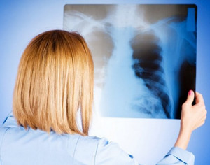 Врач смотрит на рентгеновский снимок с пневмонией