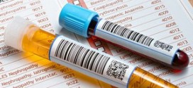 Две пробирки лежат на результатах анализа