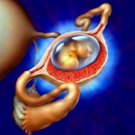 Как диагностировать внематочную беременность по гормонам?