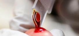 Забор крови из пальца