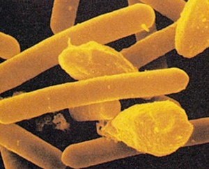 Бактерии, вызывающие ботулизм