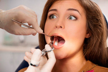 лечение зубной боли народными средствами без стоматолога