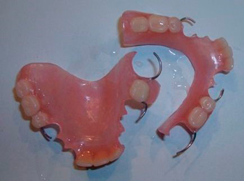 Выбор качественных нейлоновых зубных протезов