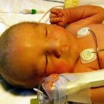 Повышенный билирубин у новорожденного: что делать. Почему бывает повышенный билирубин у новорожденного малыша
