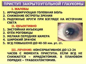 Причины и лечение закрытоугольной глаукомы