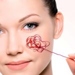 Угри на лице: лечение в домашних условиях или у косметолога. Какие рецепты эффективны для лечения угрей на лице в домашних условиях?
