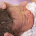 Кефалогематома у новорождённого — причины и последствия. Что делать при кефалогематоме у новорождённого