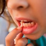 К чему снятся зубы с кровью: во рту или на ладони? Основные толкования — к чему снятся зубы с кровью по толкованию разных сонников