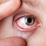 Болит глазное яблоко: возможные причины. Что делать, если болит глазное яблоко: лечение