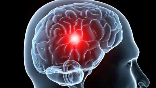Эксперты назвали привычки и болезни, способствующие уменьшению мозга