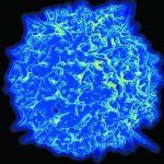 Ученые: недавнее открытие сможет уничтожить онкозаболевания