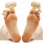Лечение грибка на ногах народными средствами: фитотерапия, сода и уксус. Рецепты лечения грибка на ногах народными средствами