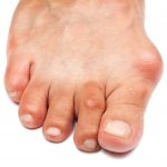 Почему болят суставы больших пальцев ног: серьёзный симптом. К кому обращаться при боли в суставе большого пальца на ноге