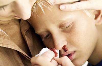 Симптомы гемофилии у детей