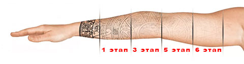 6 этапов удаления татуировки с помощью лазера