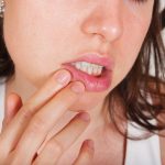Воспаление языка — причины, симптомы и лечение. Как избежать тяжёлых проявлений воспаления языка
