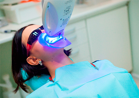 Технология фотоотбеливания зубов предполагает активацию отбеливающего геля светом специальной лампы (например, ультрафиолетовой).