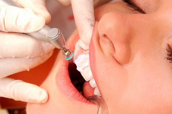 При механическом отбеливании с поверхности зубов удаляются окрашенные отложения - налет и камень.
