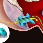 Тубоотит — что это такое, симптомы и лечение тубоотита