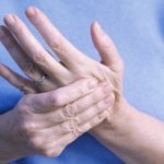 Признаком шейного хондроза считается слабость и онемение рук