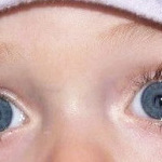 Наиболее частые болезни и травмы глаз у детей