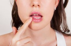 Чем помазать трещинки в уголках рта