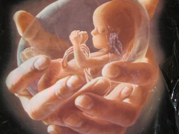 К чему снится аборт: толкования неприятного сновидения