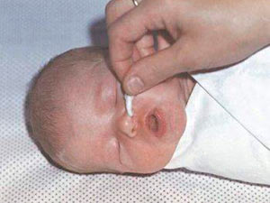 Очистка носа новорожденного от слизи ватными жгутиками