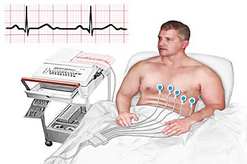 Kardiogramma-pri-priznakah-mikroinfarkta