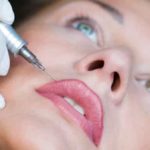 Какой филлер лучше использовать для увеличения губ и как проходит процедура?
