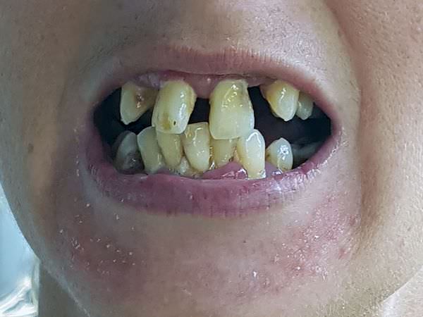 К чему снятся гнилые зубы: ответы и значения