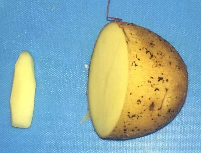 использование картофельных свечей при лечении парапроктита 