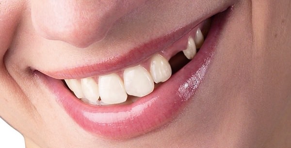 К чему снится выпадение зубов и есть ли риск остаться беззубым в реальность?