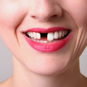 Видеть выпадение зубов без крови