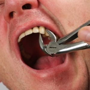 Вырвать зуб, после чего обнаружить его в своем рту