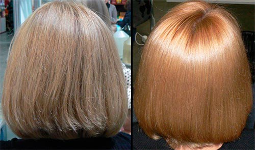 ботокс на короткие волосы — фото до и после