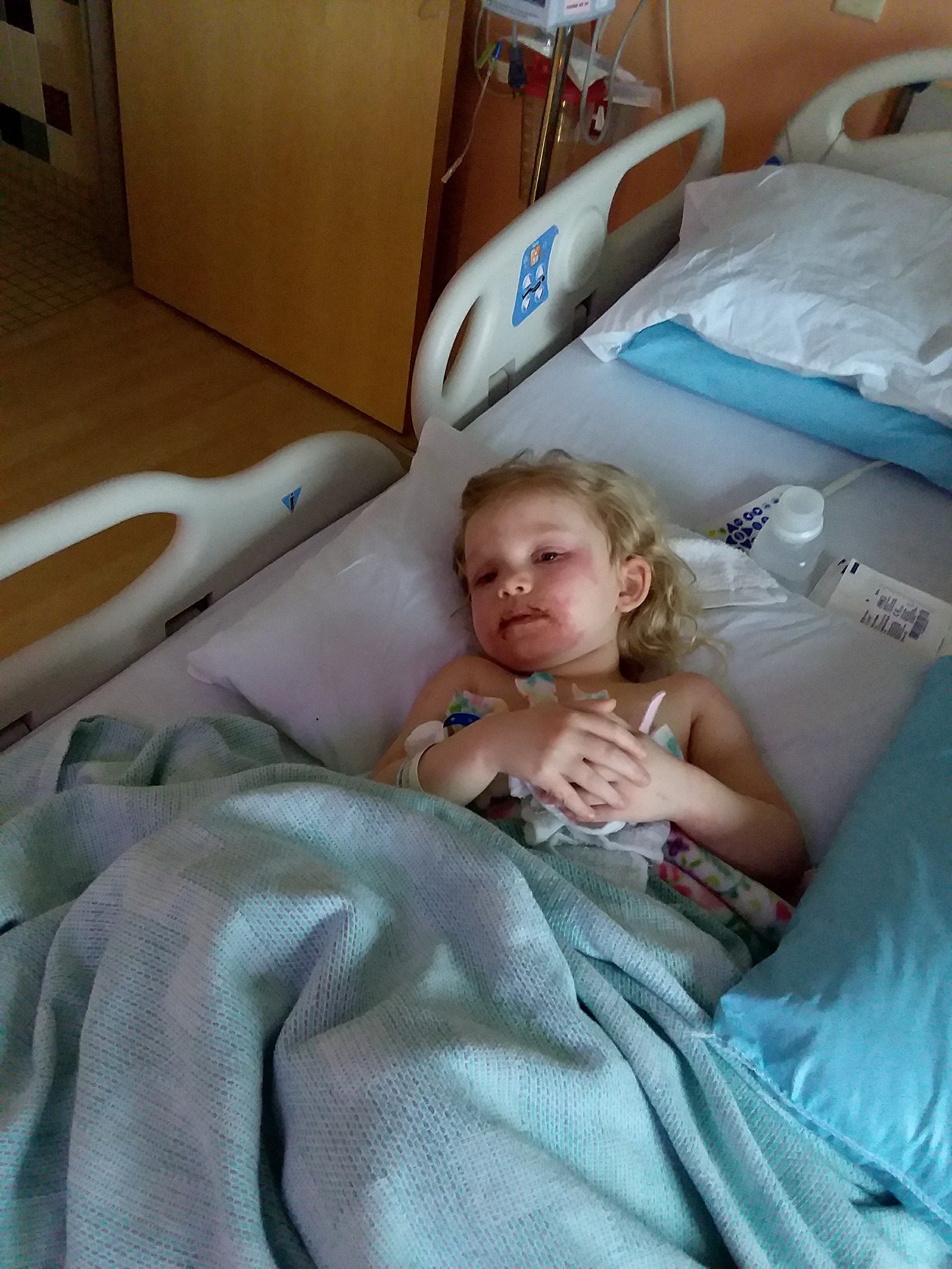 3-летняя девочка попала в больницу из-за детской косметики